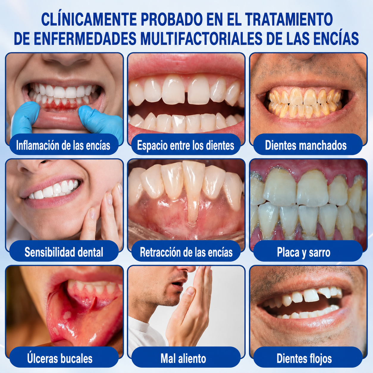 ☘️🇸🇰👨‍⚕️✅🦷Gel de reparación periodontal Healrize® GumRevive🦷🍋🍋
