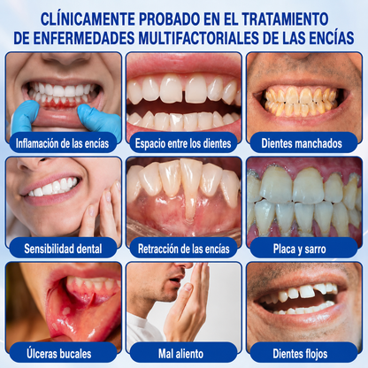 ☘️🇸🇰👨‍⚕️✅🦷Gel de reparación periodontal Healrize® GumRevive🦷🍋🍋