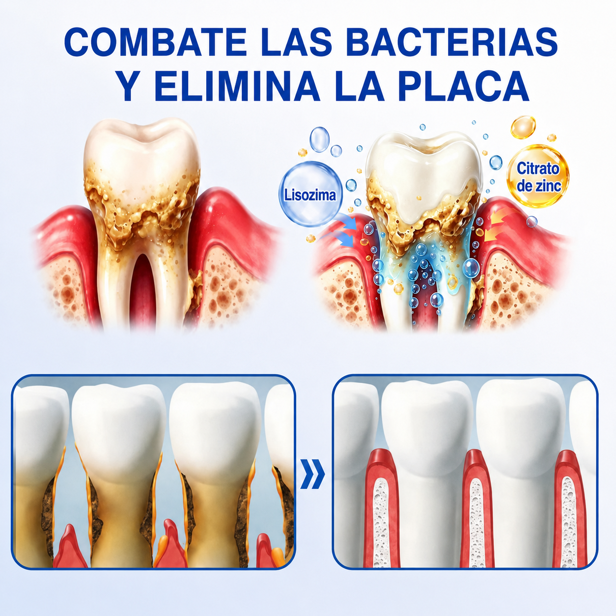 ☘️🇸🇰👨‍⚕️✅🦷Gel de reparación periodontal Healrize® GumRevive🦷🍋🍋