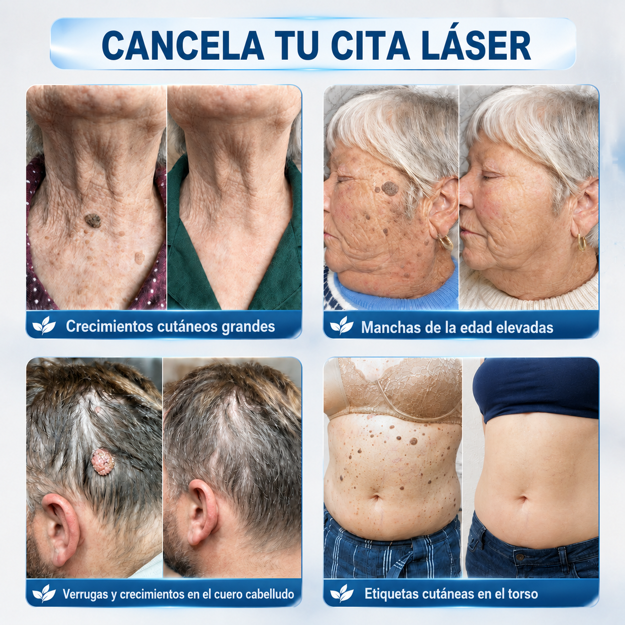 ☘️𝐇𝐞𝐚𝐥𝐫𝐢𝐳𝐞® 𝗘𝗹𝗶𝗺𝗶𝗻𝗮𝗱𝗼𝗿 𝗱𝗲 𝗠𝗮𝗿𝗰𝗮𝘀 𝘆 𝗠𝗮𝗻𝗰𝗵𝗮𝘀 𝗲𝗻 𝟳 𝗗í𝗮𝘀 (𝗦𝗶𝗻 𝗗𝗼𝗹𝗼𝗿, 𝗦𝗶𝗻 𝗖𝗶𝗰𝗮𝘁𝗿𝗶𝗰𝗲𝘀 𝗰𝗼𝗻 𝗔𝗽𝗹𝗶𝗰𝗮𝗱𝗼𝗿 𝗥𝗼𝗹𝗹𝗲𝗿𝗯𝗮𝗹𝗹)🐒2