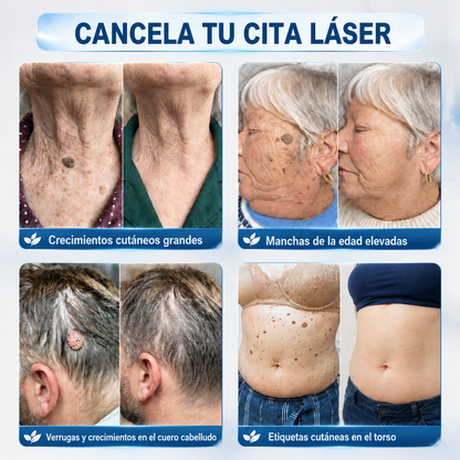 ☘️𝐇𝐞𝐚𝐥𝐫𝐢𝐳𝐞® 𝗘𝗹𝗶𝗺𝗶𝗻𝗮𝗱𝗼𝗿 𝗱𝗲 𝗠𝗮𝗿𝗰𝗮𝘀 𝘆 𝗠𝗮𝗻𝗰𝗵𝗮𝘀 𝗲𝗻 𝟳 𝗗í𝗮𝘀 (𝗦𝗶𝗻 𝗗𝗼𝗹𝗼𝗿, 𝗦𝗶𝗻 𝗖𝗶𝗰𝗮𝘁𝗿𝗶𝗰𝗲𝘀 𝗰𝗼𝗻 𝗔𝗽𝗹𝗶𝗰𝗮𝗱𝗼𝗿 𝗥𝗼𝗹𝗹𝗲𝗿𝗯𝗮𝗹𝗹)🐒2