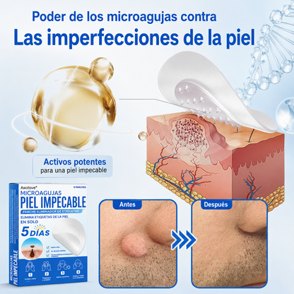 Awzlove®  𝐏𝐚𝐫𝐜𝐡𝐞𝐬 𝐡𝐢𝐝𝐫𝐨𝐜𝐨𝐥𝐨𝐢𝐝𝐞𝐬 𝐜𝐨𝐧 𝐦𝐢𝐜𝐫𝐨𝐚𝐠𝐮𝐣𝐚𝐬 𝟐 𝐞𝐧 𝟏  𝐄𝐬𝐩𝐞𝐜𝐢𝐚𝐥𝐦𝐞𝐧𝐭𝐞 𝐝𝐢𝐬𝐞ñ𝐚𝐝𝐨𝐬 𝐩𝐚𝐫𝐚 𝐞𝐥𝐢𝐦𝐢𝐧𝐚𝐫 𝐥𝐮𝐧𝐚𝐫𝐞𝐬 𝐞𝐥𝐞𝐯𝐚𝐝𝐨𝐬, 𝐚𝐜𝐧é, 𝐯𝐞𝐫𝐫𝐮𝐠𝐚𝐬 𝐩𝐥𝐚𝐧𝐚𝐬 𝐲 𝐩𝐫𝐨𝐭𝐮𝐛𝐞𝐫𝐚𝐧𝐜𝐢𝐚𝐬 𝐜𝐮𝐭á𝐧𝐞𝐚𝐬 | 𝐏𝐚𝐪𝐮𝐞𝐭𝐞 𝐝𝐞 𝟏𝟒𝟒 𝐮𝐧𝐢𝐝𝐚𝐝𝐞𝐬  🐒🐶1