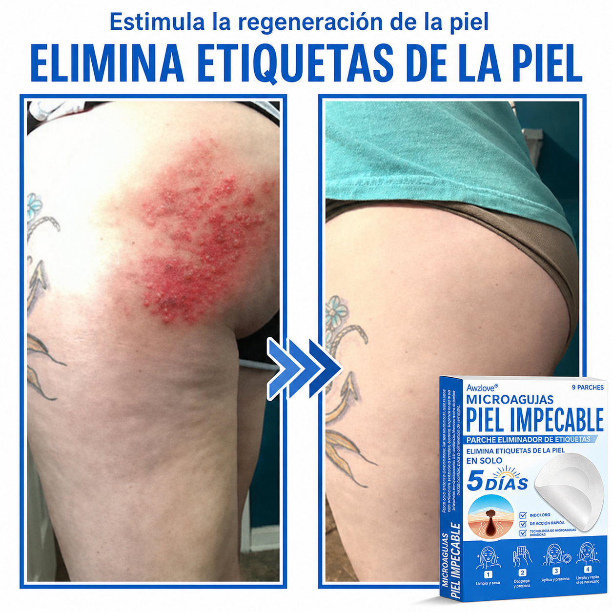 Awzlove®  𝐏𝐚𝐫𝐜𝐡𝐞𝐬 𝐡𝐢𝐝𝐫𝐨𝐜𝐨𝐥𝐨𝐢𝐝𝐞𝐬 𝐜𝐨𝐧 𝐦𝐢𝐜𝐫𝐨𝐚𝐠𝐮𝐣𝐚𝐬 𝟐 𝐞𝐧 𝟏  𝐄𝐬𝐩𝐞𝐜𝐢𝐚𝐥𝐦𝐞𝐧𝐭𝐞 𝐝𝐢𝐬𝐞ñ𝐚𝐝𝐨𝐬 𝐩𝐚𝐫𝐚 𝐞𝐥𝐢𝐦𝐢𝐧𝐚𝐫 𝐥𝐮𝐧𝐚𝐫𝐞𝐬 𝐞𝐥𝐞𝐯𝐚𝐝𝐨𝐬, 𝐚𝐜𝐧é, 𝐯𝐞𝐫𝐫𝐮𝐠𝐚𝐬 𝐩𝐥𝐚𝐧𝐚𝐬 𝐲 𝐩𝐫𝐨𝐭𝐮𝐛𝐞𝐫𝐚𝐧𝐜𝐢𝐚𝐬 𝐜𝐮𝐭á𝐧𝐞𝐚𝐬 | 𝐏𝐚𝐪𝐮𝐞𝐭𝐞 𝐝𝐞 𝟏𝟒𝟒 𝐮𝐧𝐢𝐝𝐚𝐝𝐞𝐬  🐒🐶1