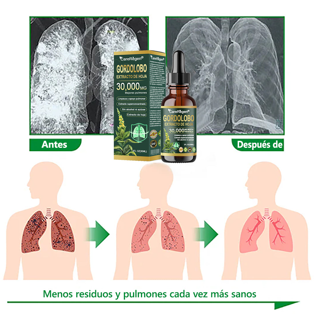 𝗧𝗶𝗲𝗻𝗱𝗮 𝗢𝗳𝗶𝗰𝗶𝗮𝗹: 𝗖𝗮𝗿𝗲𝗥𝗲𝗴𝗲𝗻® 𝗘𝘅𝘁𝗿𝗮𝗰𝘁𝗼 𝗢𝗿𝗴á𝗻𝗶𝗰𝗼 𝗱𝗲 𝗛𝗼𝗷𝗮 𝗱𝗲 𝗚𝗼𝗿𝗱𝗼𝗹𝗼𝗯𝗼 𝗽𝗮𝗿𝗮 𝗟𝗶𝗺𝗽𝗶𝗲𝘇𝗮 𝗣𝘂𝗹𝗺𝗼𝗻𝗮𝗿 𝐅ó𝐫𝐦𝐮𝐥𝐚 𝐜𝐥í𝐧𝐢𝐜𝐚𝐦𝐞𝐧𝐭𝐞 𝐩𝐫𝐨𝐛𝐚𝐝𝐚 𝐲 𝐚𝐥𝐭𝐚𝐦𝐞𝐧𝐭𝐞 𝐜𝐨𝐧𝐜𝐞𝐧𝐭𝐫𝐚𝐝𝐚 𝐪𝐮𝐞 𝐚𝐲𝐮𝐝𝐚 𝐚 𝐚𝐥𝐢𝐯𝐢𝐚𝐫 𝐥𝐚 𝐭𝐨𝐬, 𝐥𝐚 𝐟𝐥𝐞𝐦𝐚, 𝐞𝐥 𝐚𝐬𝐦𝐚 𝐲 𝐥𝐚 𝐂𝐎𝐏𝐃 — ✅𝐫𝐞𝐬𝐩𝐢𝐫𝐚 𝐦𝐞𝐣𝐨𝐫, 𝐦á𝐬 𝐫á𝐩𝐢𝐝𝐨.✅