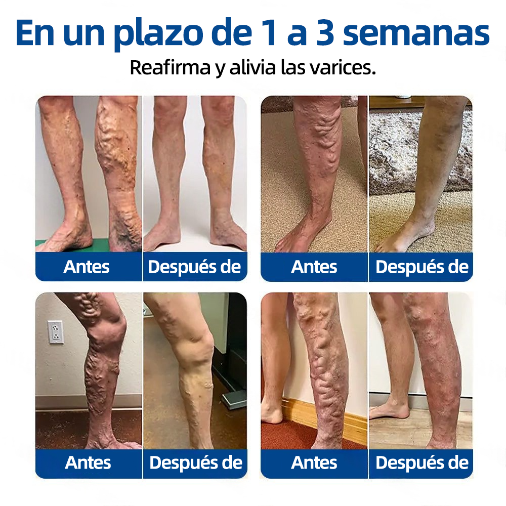 𝗛𝗲𝗮𝗹𝗿𝗶𝘇𝗲® 𝗣𝗮𝗿𝗰𝗵𝗲 𝗠𝗶𝗰𝗿𝗼𝗻𝗲𝗲𝗱𝗹𝗲 𝗩𝗲𝗶𝗻𝗧𝗮𝗿𝗴𝗲𝘁 𝗔𝗹𝗶𝘃𝗶𝗼 𝗜𝗻𝘀𝘁𝗮𝗻𝘁𝗮́𝗻𝗲𝗼, 𝗥𝗲𝘀𝘂𝗹𝘁𝗮𝗱𝗼𝘀 𝗮 𝗟𝗮𝗿𝗴𝗼 𝗣𝗹𝗮𝘇𝗼🏃‍♂️‍➡️🏃‍♂️‍➡️1