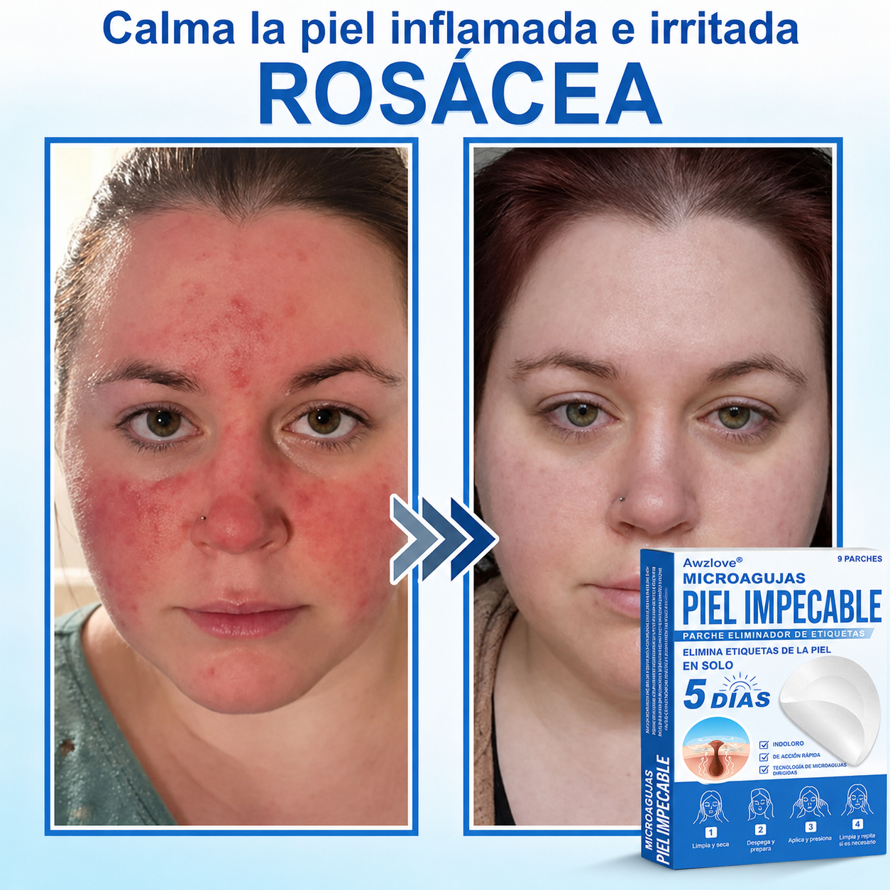 Awzlove®  𝐏𝐚𝐫𝐜𝐡𝐞𝐬 𝐡𝐢𝐝𝐫𝐨𝐜𝐨𝐥𝐨𝐢𝐝𝐞𝐬 𝐜𝐨𝐧 𝐦𝐢𝐜𝐫𝐨𝐚𝐠𝐮𝐣𝐚𝐬 𝟐 𝐞𝐧 𝟏  𝐄𝐬𝐩𝐞𝐜𝐢𝐚𝐥𝐦𝐞𝐧𝐭𝐞 𝐝𝐢𝐬𝐞ñ𝐚𝐝𝐨𝐬 𝐩𝐚𝐫𝐚 𝐞𝐥𝐢𝐦𝐢𝐧𝐚𝐫 𝐥𝐮𝐧𝐚𝐫𝐞𝐬 𝐞𝐥𝐞𝐯𝐚𝐝𝐨𝐬, 𝐚𝐜𝐧é, 𝐯𝐞𝐫𝐫𝐮𝐠𝐚𝐬 𝐩𝐥𝐚𝐧𝐚𝐬 𝐲 𝐩𝐫𝐨𝐭𝐮𝐛𝐞𝐫𝐚𝐧𝐜𝐢𝐚𝐬 𝐜𝐮𝐭á𝐧𝐞𝐚𝐬 | 𝐏𝐚𝐪𝐮𝐞𝐭𝐞 𝐝𝐞 𝟏𝟒𝟒 𝐮𝐧𝐢𝐝𝐚𝐝𝐞𝐬  🐒🐶1
