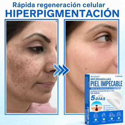 Awzlove®  𝐏𝐚𝐫𝐜𝐡𝐞𝐬 𝐡𝐢𝐝𝐫𝐨𝐜𝐨𝐥𝐨𝐢𝐝𝐞𝐬 𝐜𝐨𝐧 𝐦𝐢𝐜𝐫𝐨𝐚𝐠𝐮𝐣𝐚𝐬 𝟐 𝐞𝐧 𝟏  𝐄𝐬𝐩𝐞𝐜𝐢𝐚𝐥𝐦𝐞𝐧𝐭𝐞 𝐝𝐢𝐬𝐞ñ𝐚𝐝𝐨𝐬 𝐩𝐚𝐫𝐚 𝐞𝐥𝐢𝐦𝐢𝐧𝐚𝐫 𝐥𝐮𝐧𝐚𝐫𝐞𝐬 𝐞𝐥𝐞𝐯𝐚𝐝𝐨𝐬, 𝐚𝐜𝐧é, 𝐯𝐞𝐫𝐫𝐮𝐠𝐚𝐬 𝐩𝐥𝐚𝐧𝐚𝐬 𝐲 𝐩𝐫𝐨𝐭𝐮𝐛𝐞𝐫𝐚𝐧𝐜𝐢𝐚𝐬 𝐜𝐮𝐭á𝐧𝐞𝐚𝐬 | 𝐏𝐚𝐪𝐮𝐞𝐭𝐞 𝐝𝐞 𝟏𝟒𝟒 𝐮𝐧𝐢𝐝𝐚𝐝𝐞𝐬  🐒🐶1