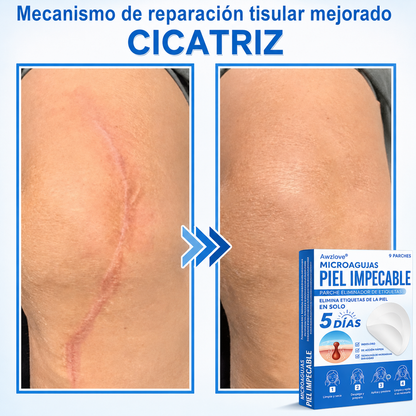 Awzlove®  𝐏𝐚𝐫𝐜𝐡𝐞𝐬 𝐡𝐢𝐝𝐫𝐨𝐜𝐨𝐥𝐨𝐢𝐝𝐞𝐬 𝐜𝐨𝐧 𝐦𝐢𝐜𝐫𝐨𝐚𝐠𝐮𝐣𝐚𝐬 𝟐 𝐞𝐧 𝟏  𝐄𝐬𝐩𝐞𝐜𝐢𝐚𝐥𝐦𝐞𝐧𝐭𝐞 𝐝𝐢𝐬𝐞ñ𝐚𝐝𝐨𝐬 𝐩𝐚𝐫𝐚 𝐞𝐥𝐢𝐦𝐢𝐧𝐚𝐫 𝐥𝐮𝐧𝐚𝐫𝐞𝐬 𝐞𝐥𝐞𝐯𝐚𝐝𝐨𝐬, 𝐚𝐜𝐧é, 𝐯𝐞𝐫𝐫𝐮𝐠𝐚𝐬 𝐩𝐥𝐚𝐧𝐚𝐬 𝐲 𝐩𝐫𝐨𝐭𝐮𝐛𝐞𝐫𝐚𝐧𝐜𝐢𝐚𝐬 𝐜𝐮𝐭á𝐧𝐞𝐚𝐬 | 𝐏𝐚𝐪𝐮𝐞𝐭𝐞 𝐝𝐞 𝟏𝟒𝟒 𝐮𝐧𝐢𝐝𝐚𝐝𝐞𝐬  🐒🐶1