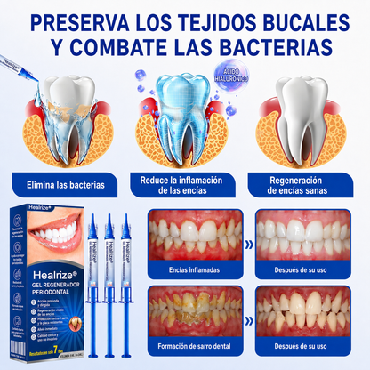 ☘️🇸🇰👨‍⚕️✅🦷Gel de reparación periodontal Healrize® GumRevive🦷🍋🍋