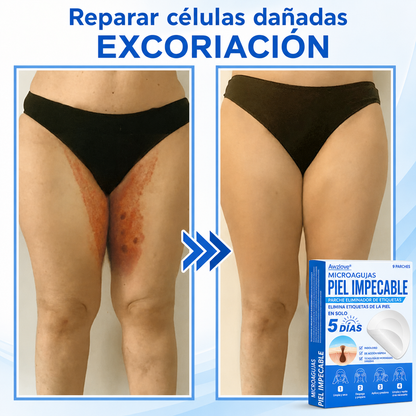 Awzlove®  𝐏𝐚𝐫𝐜𝐡𝐞𝐬 𝐡𝐢𝐝𝐫𝐨𝐜𝐨𝐥𝐨𝐢𝐝𝐞𝐬 𝐜𝐨𝐧 𝐦𝐢𝐜𝐫𝐨𝐚𝐠𝐮𝐣𝐚𝐬 𝟐 𝐞𝐧 𝟏  𝐄𝐬𝐩𝐞𝐜𝐢𝐚𝐥𝐦𝐞𝐧𝐭𝐞 𝐝𝐢𝐬𝐞ñ𝐚𝐝𝐨𝐬 𝐩𝐚𝐫𝐚 𝐞𝐥𝐢𝐦𝐢𝐧𝐚𝐫 𝐥𝐮𝐧𝐚𝐫𝐞𝐬 𝐞𝐥𝐞𝐯𝐚𝐝𝐨𝐬, 𝐚𝐜𝐧é, 𝐯𝐞𝐫𝐫𝐮𝐠𝐚𝐬 𝐩𝐥𝐚𝐧𝐚𝐬 𝐲 𝐩𝐫𝐨𝐭𝐮𝐛𝐞𝐫𝐚𝐧𝐜𝐢𝐚𝐬 𝐜𝐮𝐭á𝐧𝐞𝐚𝐬 | 𝐏𝐚𝐪𝐮𝐞𝐭𝐞 𝐝𝐞 𝟏𝟒𝟒 𝐮𝐧𝐢𝐝𝐚𝐝𝐞𝐬  🐒🐶1