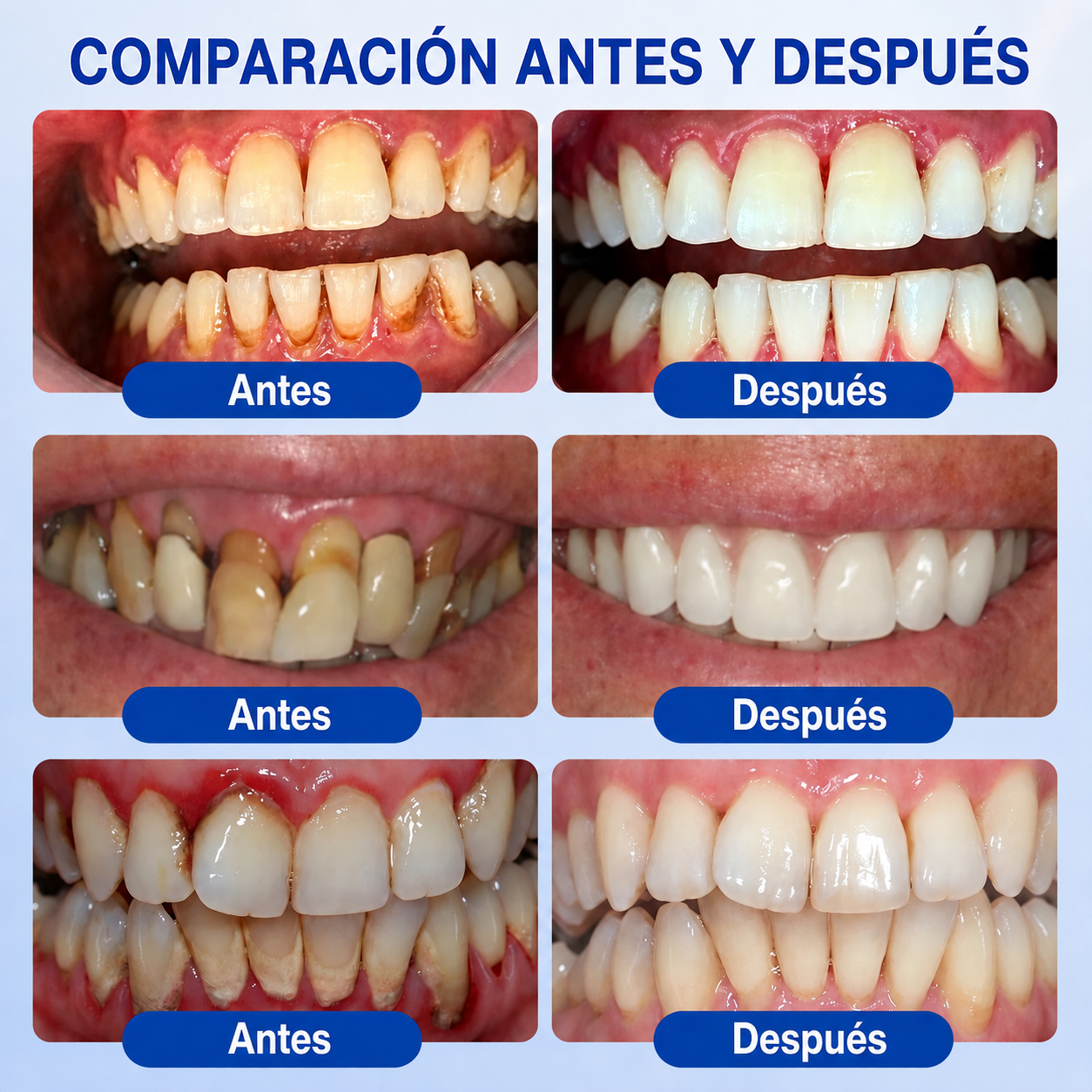 ☘️🇸🇰👨‍⚕️✅🦷Gel de reparación periodontal Healrize® GumRevive🦷🍋🍋